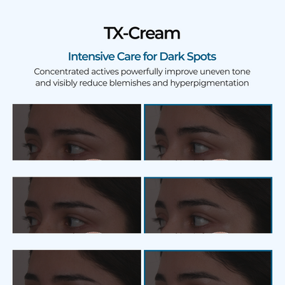 TX Cream