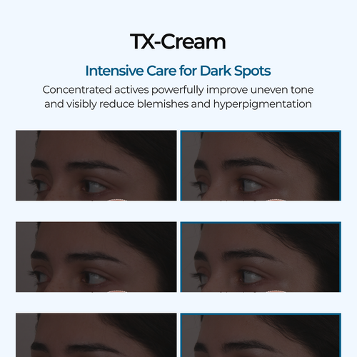 TX Cream